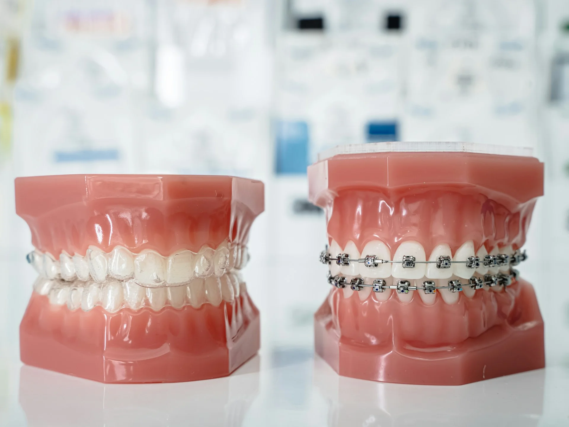 Quel est le prix d'un traitement d'orthodontie