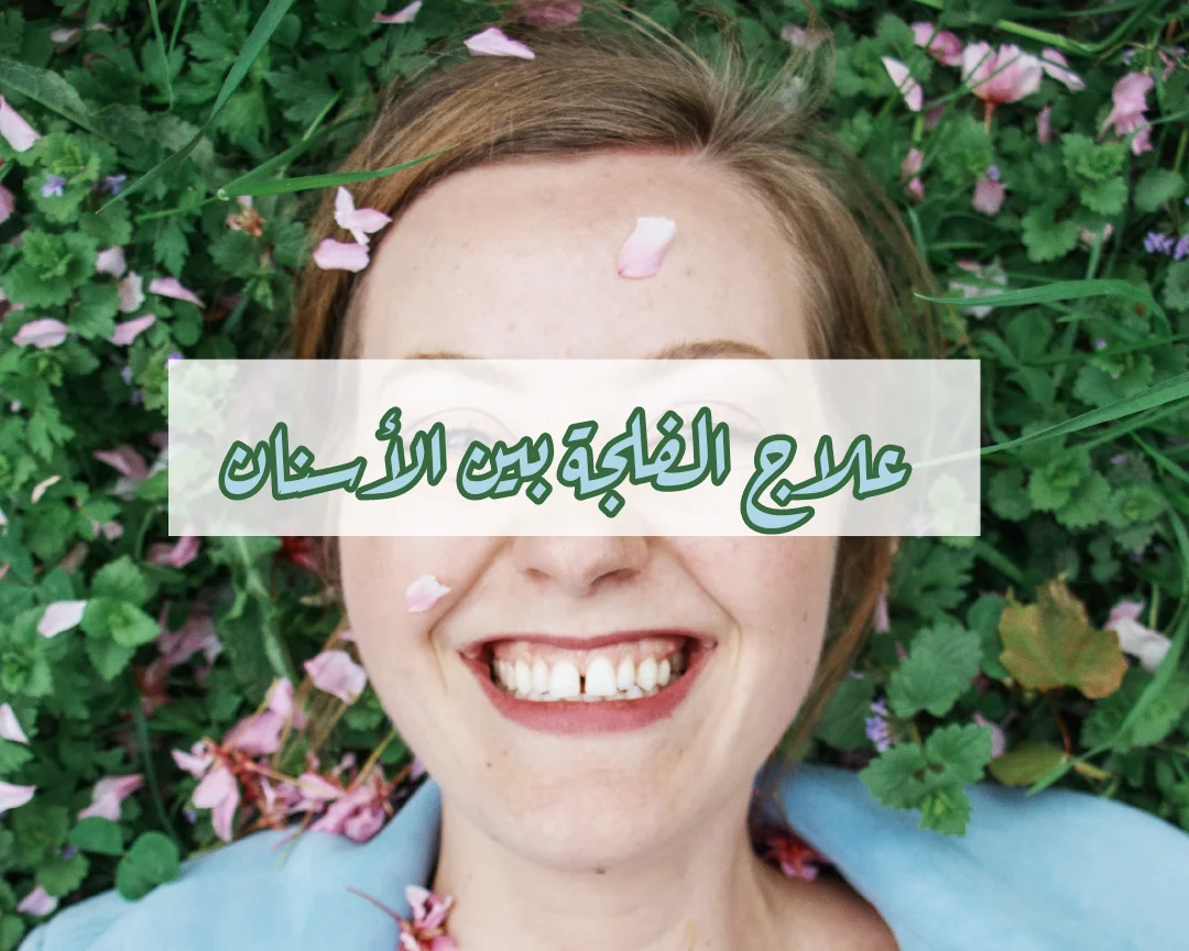 علاج الفلجة بين الأسنان الأمامية في تونس